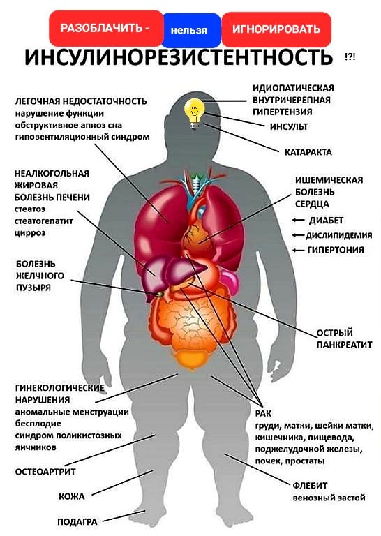 ИНСУЛИНОРЕЗИСТЕНТНОСТЬ: разоблачить - нельзя игнорировать!