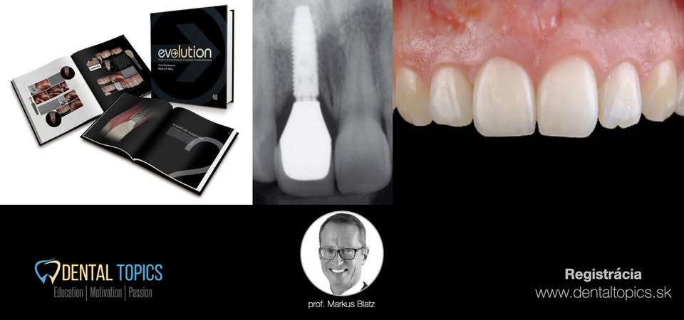 MASTERING CERAMIC RESTORATIONS IN ESTHETIC DENTISTRY