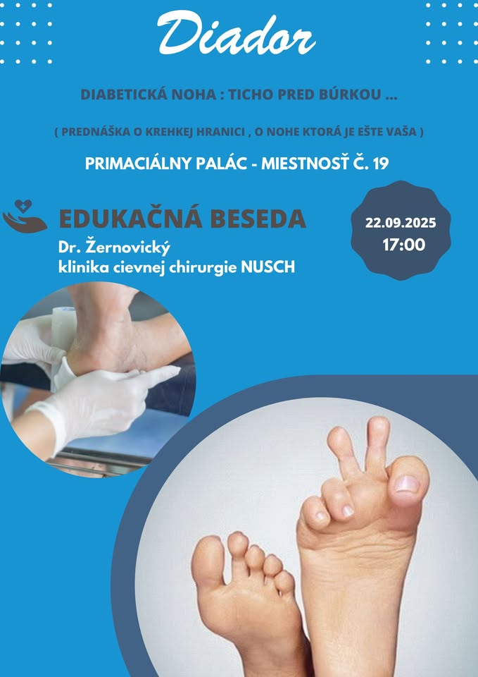 Edukačná beseda: Diabetická noha: Ticho pred búrkou
