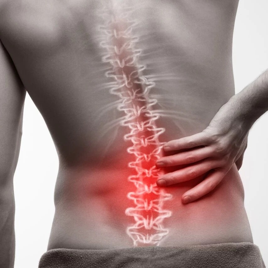 Minimal-invasive Wirbelsäulenchirurgie | Medizinischer Infoabend